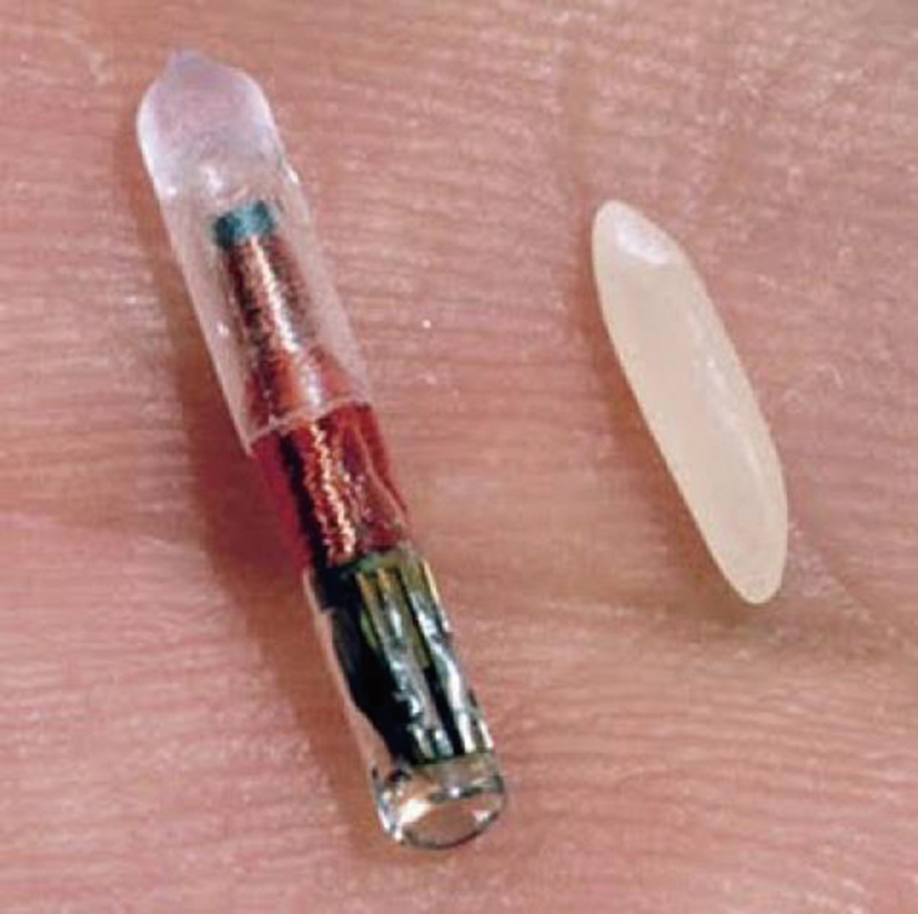 Microchip_rfid_rice.jpg